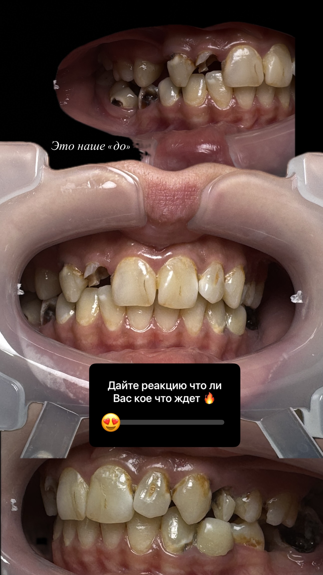 Результат лечения