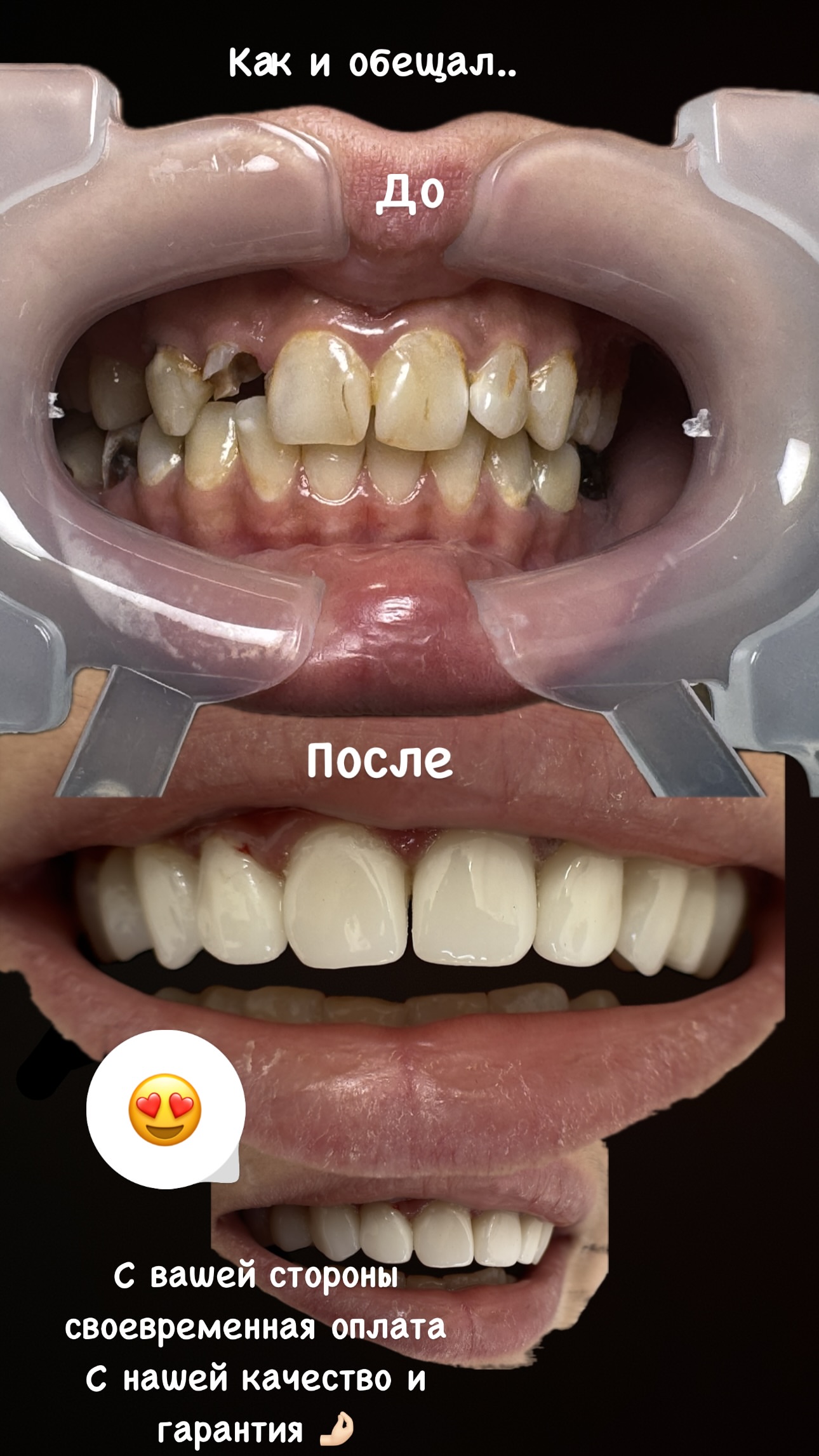 Результат лечения