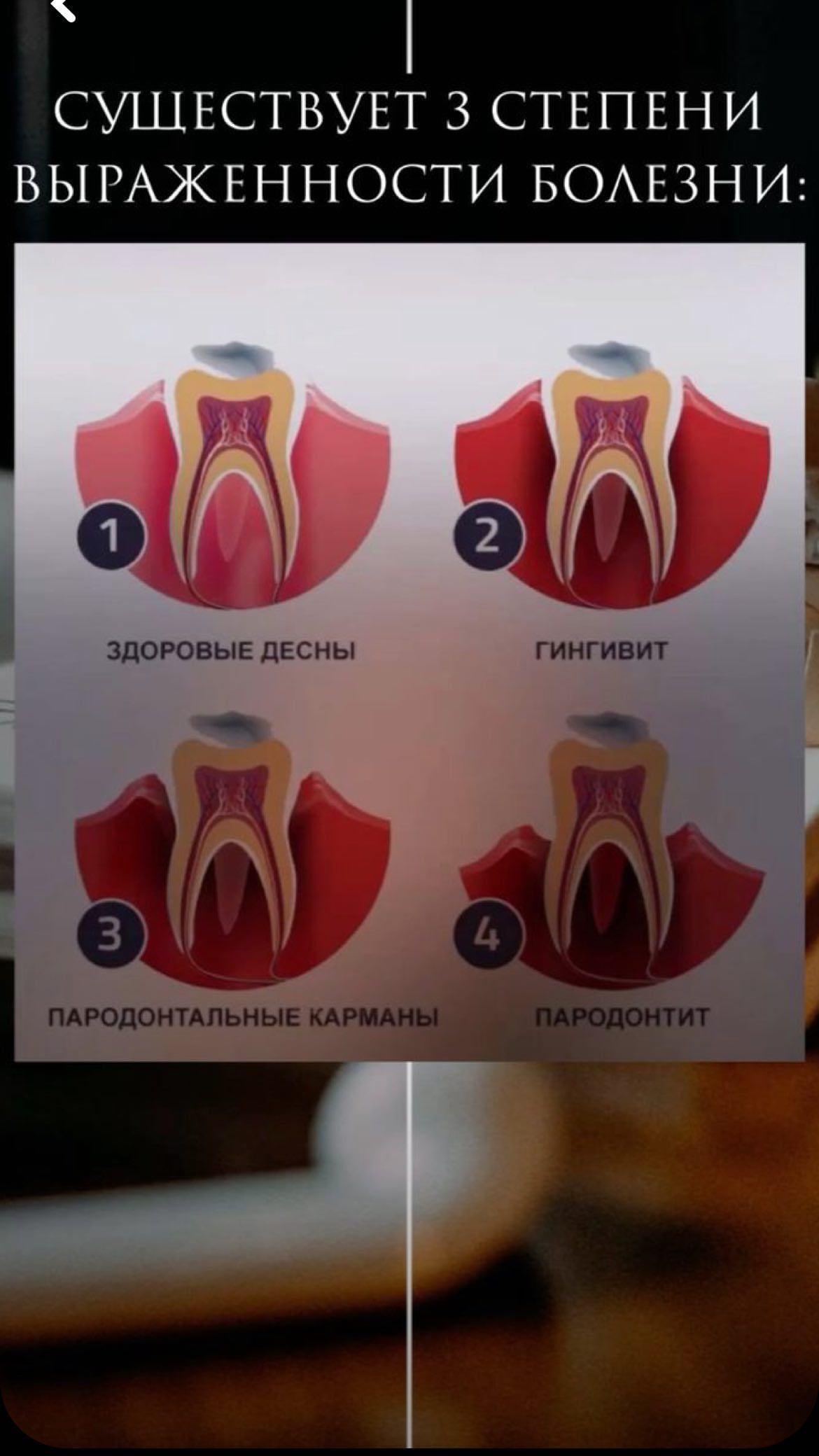 Результат лечения