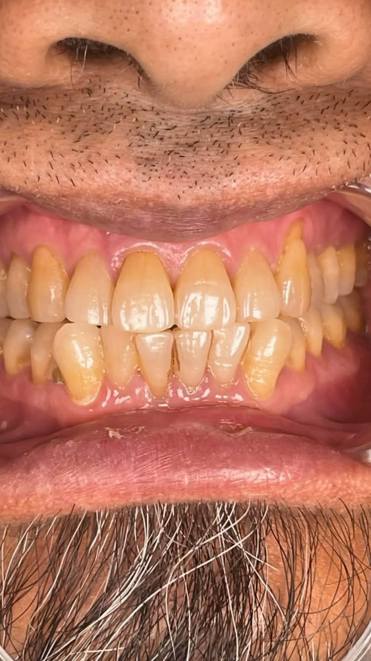 Результат лечения